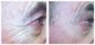 2 in 1 multifunzionale IPL Hair Removal bellezza apparecchiature Laser con dimensione Spot 15 * 50 mm ²