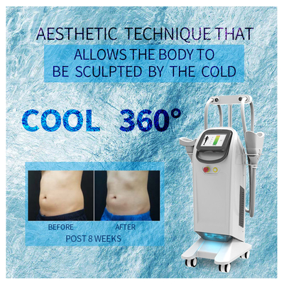 La macchina 5 di 360 Cryolipolysis tratta il congelamento del grasso corporeo