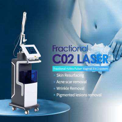 La macchina laser frazionata al CO2 è la soluzione più avanzata per la rimozione delle cicatrici.